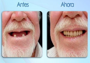 antes-y-despues-7