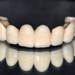 puente-zirconio-01